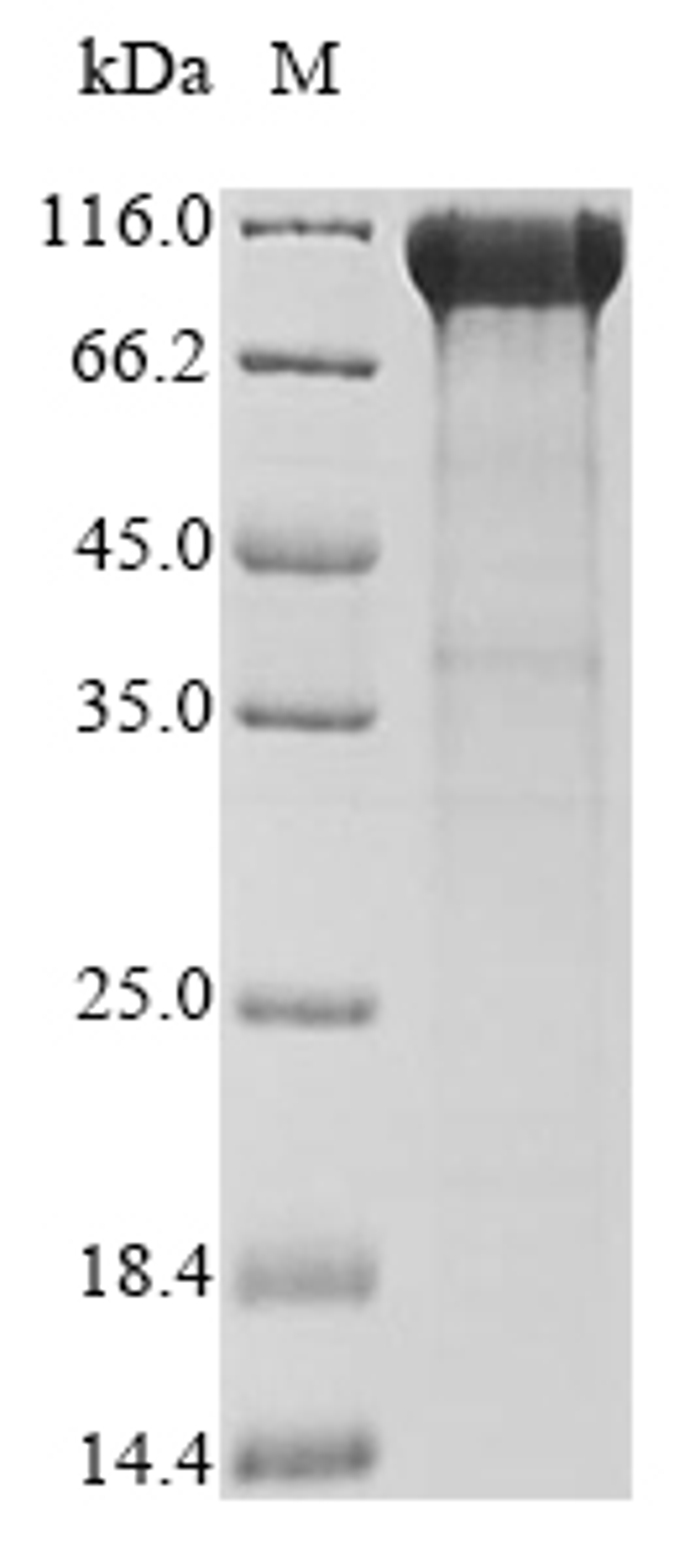 (Tris-Glycine gel) Discontinuous SDS-PAGE (reduced) with 5% enrichment gel and 15% separation gel.
