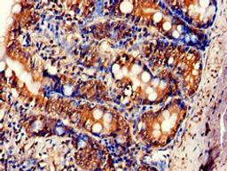 Immunohistochemistry of paraffin-embedded human small intestine tissue using CSB-PA007925LA01HU at dilution of 1:100