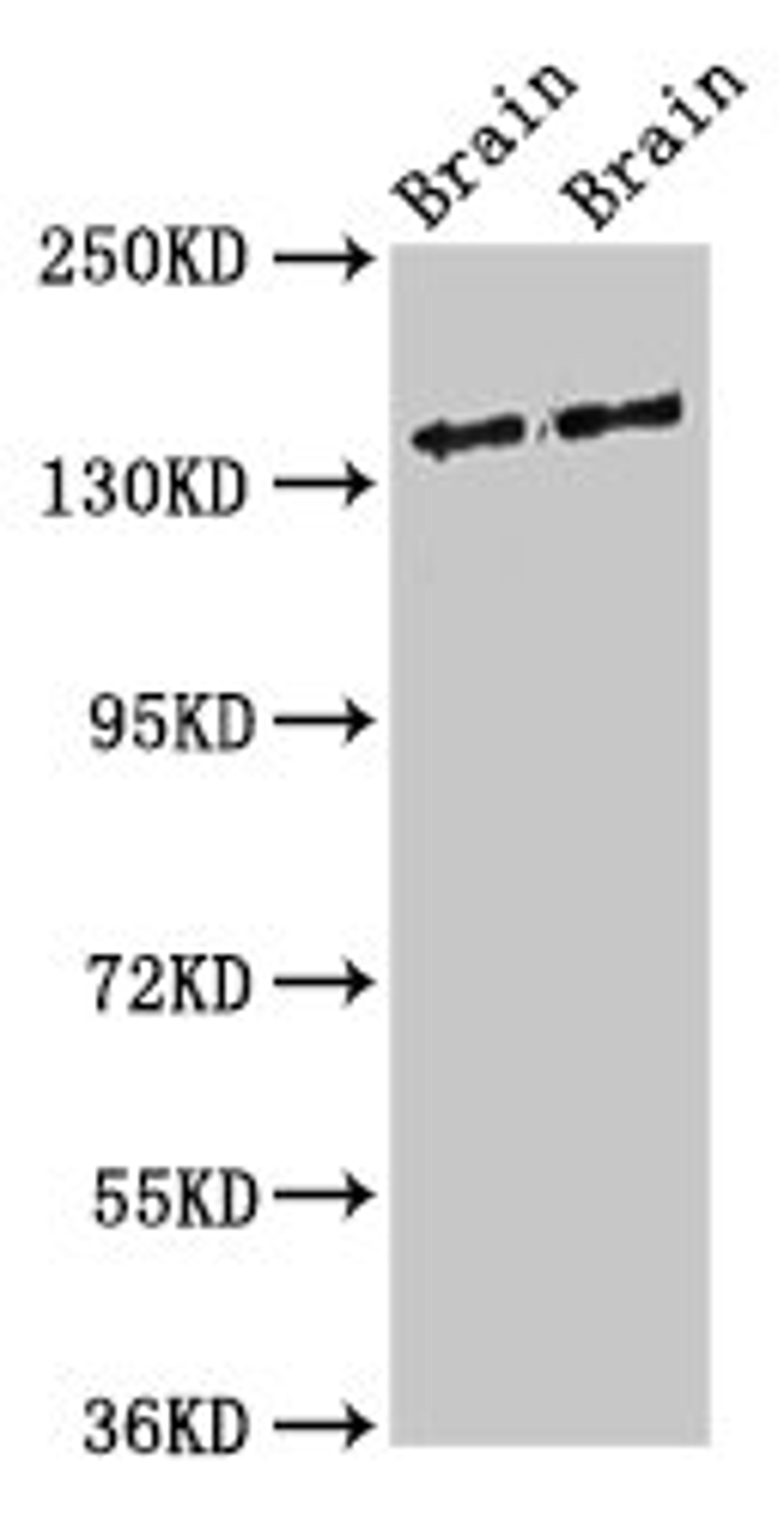 Western Blot. Positive WB detected in: Rat brain tissue, Mouse brain tissue. All lanes: MAST3 antibody at 3ug/ml. Secondary. Goat polyclonal to rabbit IgG at 1/50000 dilution. Predicted band size: 144 kDa. Observed band size: 144 kDa. 