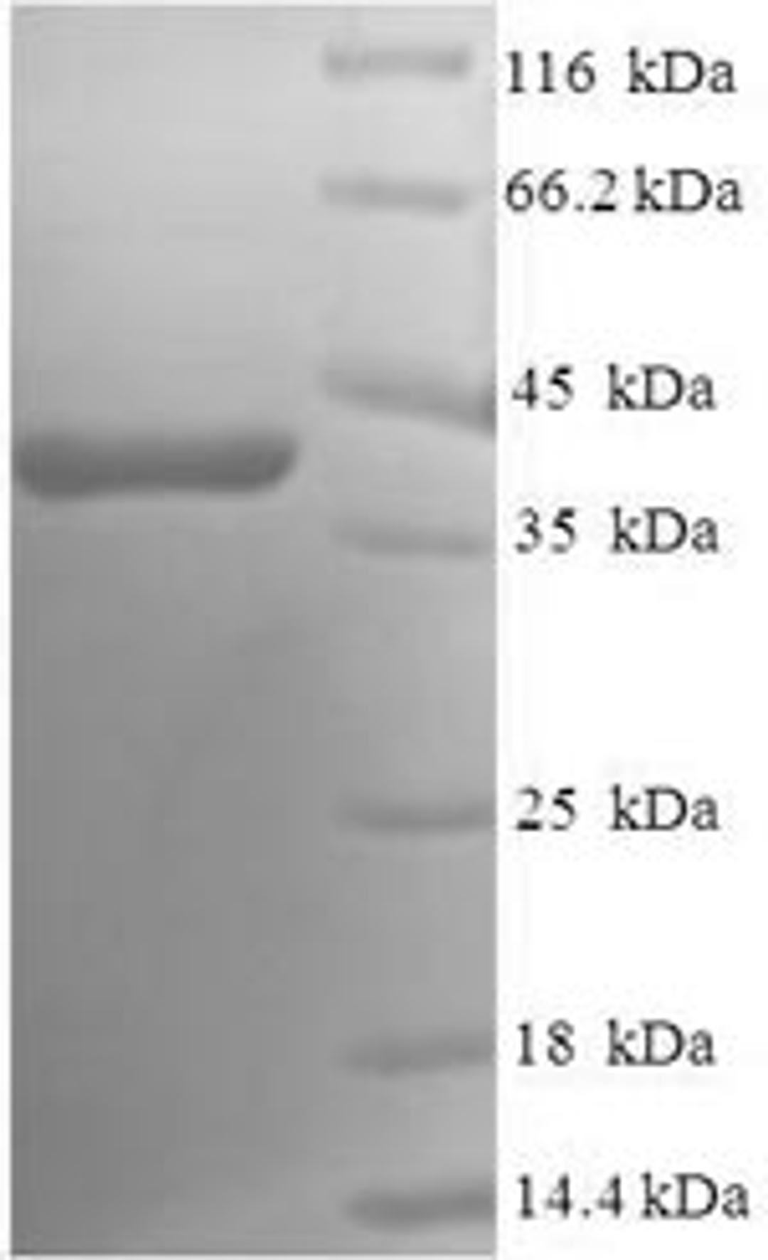 (Tris-Glycine gel) Discontinuous SDS-PAGE (reduced) with 5% enrichment gel and 15% separation gel.
