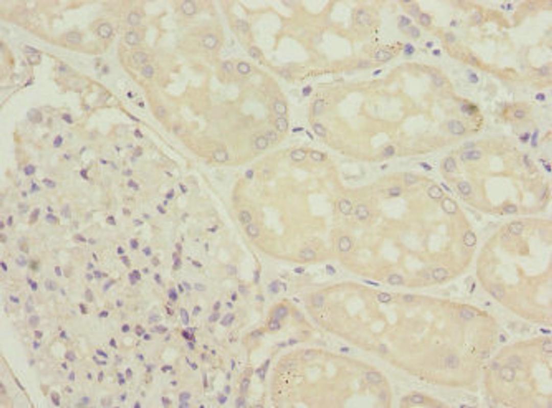 Immunohistochemistry of paraffin-embedded human kidney tissue using CSB-PA800100ESR2HU at dilution of 1:100