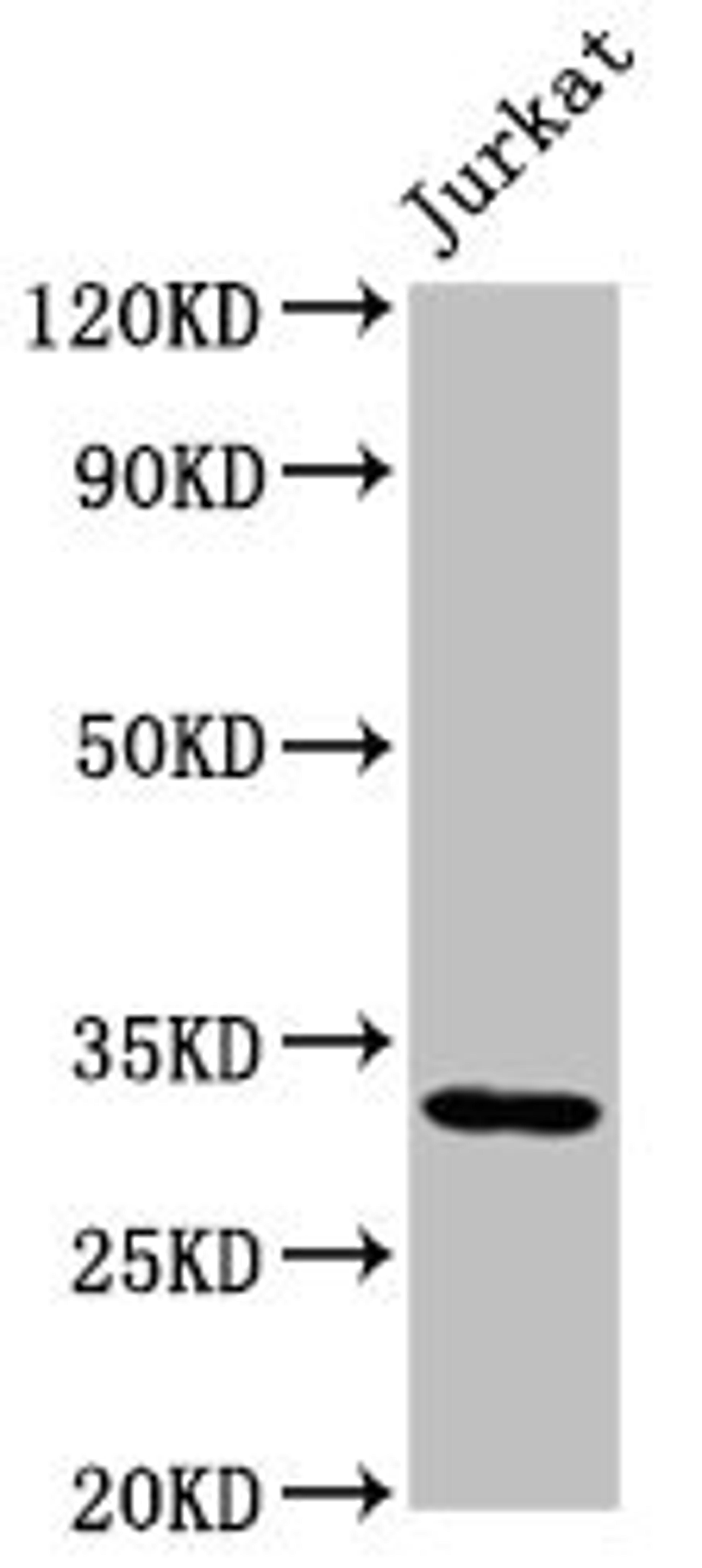 Western Blot. Positive WB detected in: Jurkat whole cell lysate. All lanes: PSMG1 antibody at 2µg/ml. Secondary. Goat polyclonal to rabbit IgG at 1/50000 dilution. Predicted band size: 33, 31 kDa. Observed band size: 33 kDa