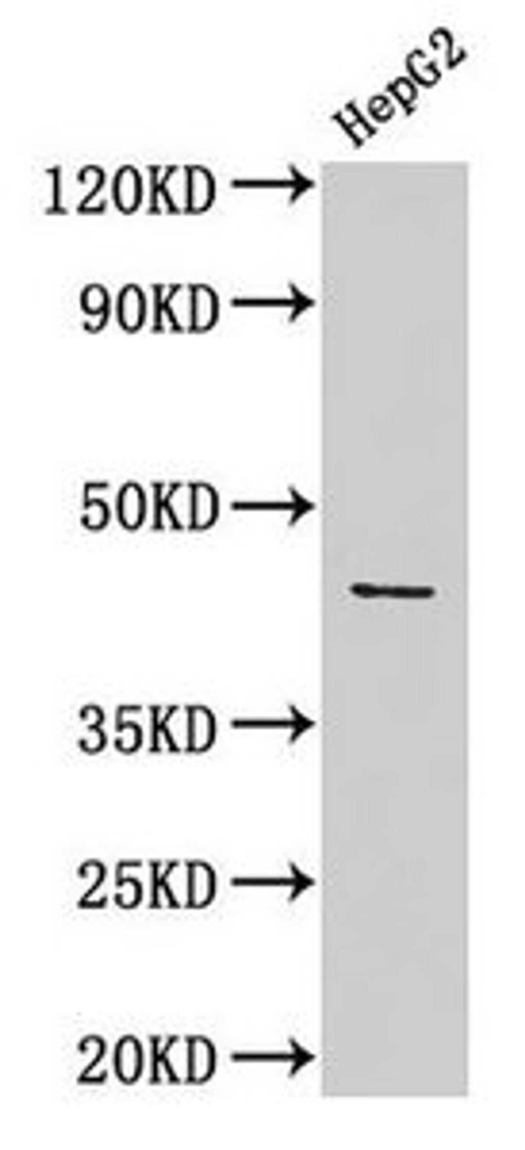 Western Blot. Positive WB detected in: HepG2 whole cell lysate. All lanes: ACTB antibody at 1:1000. Secondary. Goat polyclonal to rabbit IgG at 1/50000 dilution. Predicted band size: 42 kDa. Observed band size: 42 kDa