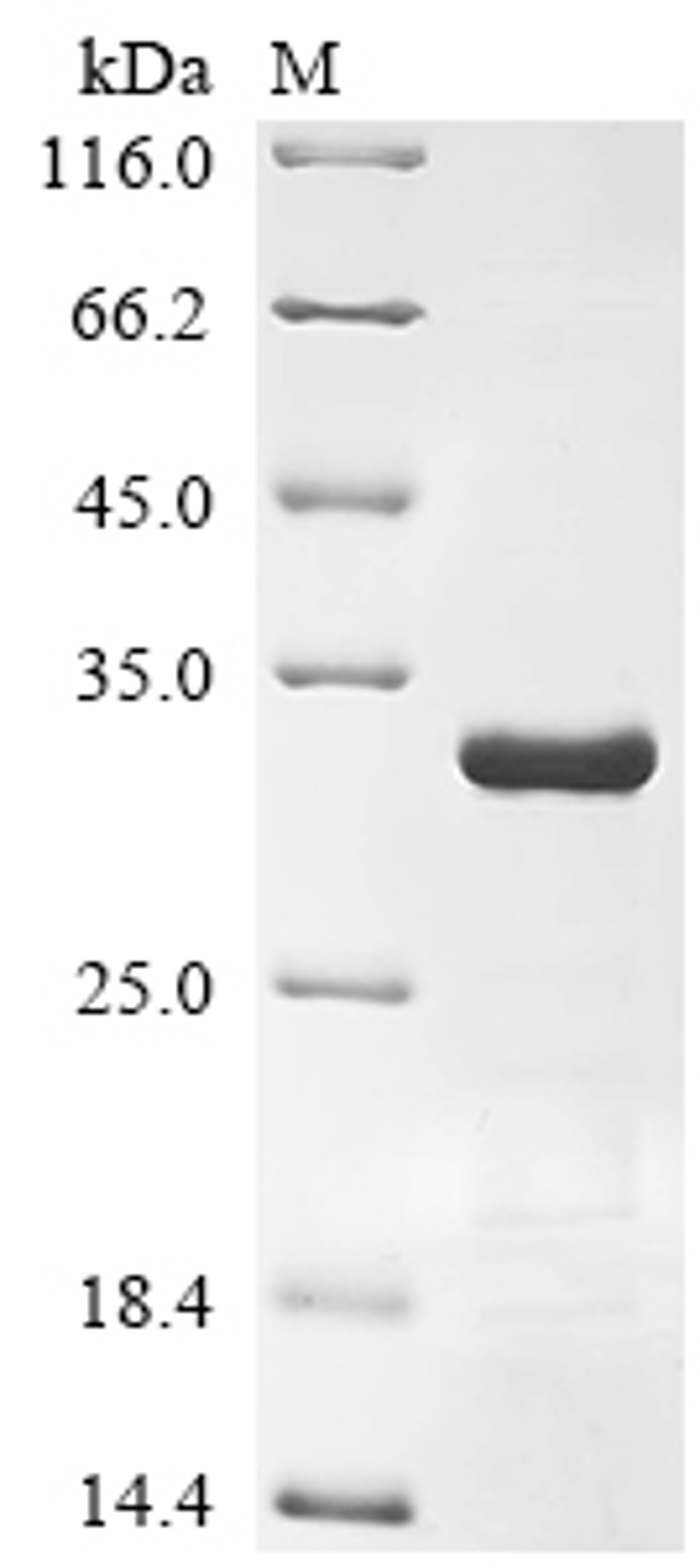(Tris-Glycine gel) Discontinuous SDS-PAGE (reduced) with 5% enrichment gel and 15% separation gel.