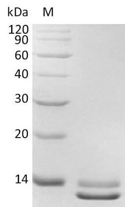 (Tris-Glycine gel) Discontinuous SDS-PAGE (reduced) with 5% enrichment gel and 15% separation gel.