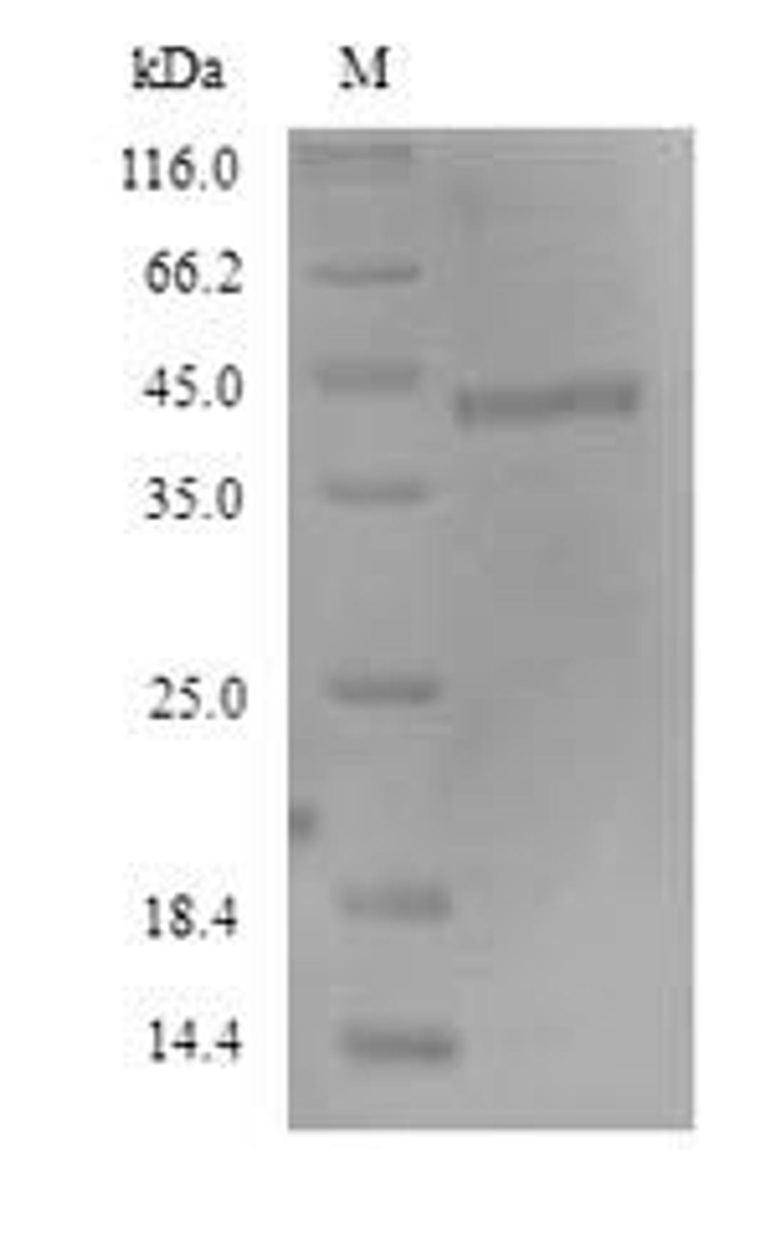 (Tris-Glycine gel) Discontinuous SDS-PAGE (reduced) with 5% enrichment gel and 15% separation gel.