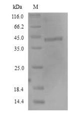 (Tris-Glycine gel) Discontinuous SDS-PAGE (reduced) with 5% enrichment gel and 15% separation gel.