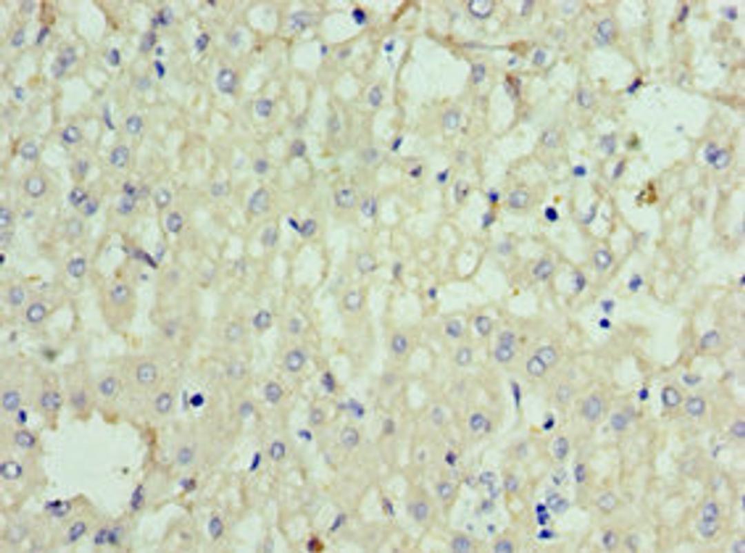 Immunohistochemistry of paraffin-embedded human liver tissue using CSB-PA858415ESR1HU at dilution of 1:100