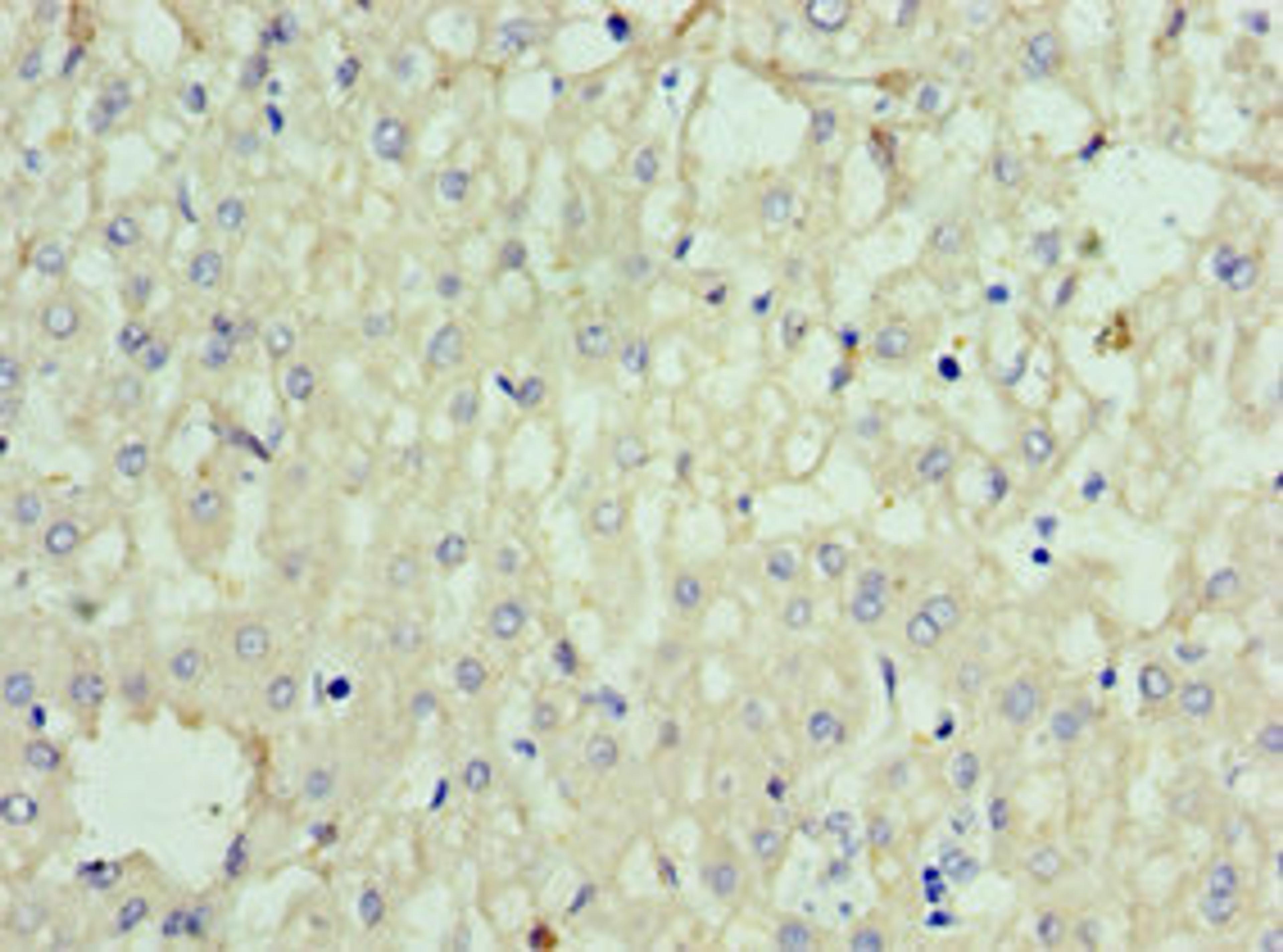 Immunohistochemistry of paraffin-embedded human liver tissue using CSB-PA858415ESR1HU at dilution of 1:100