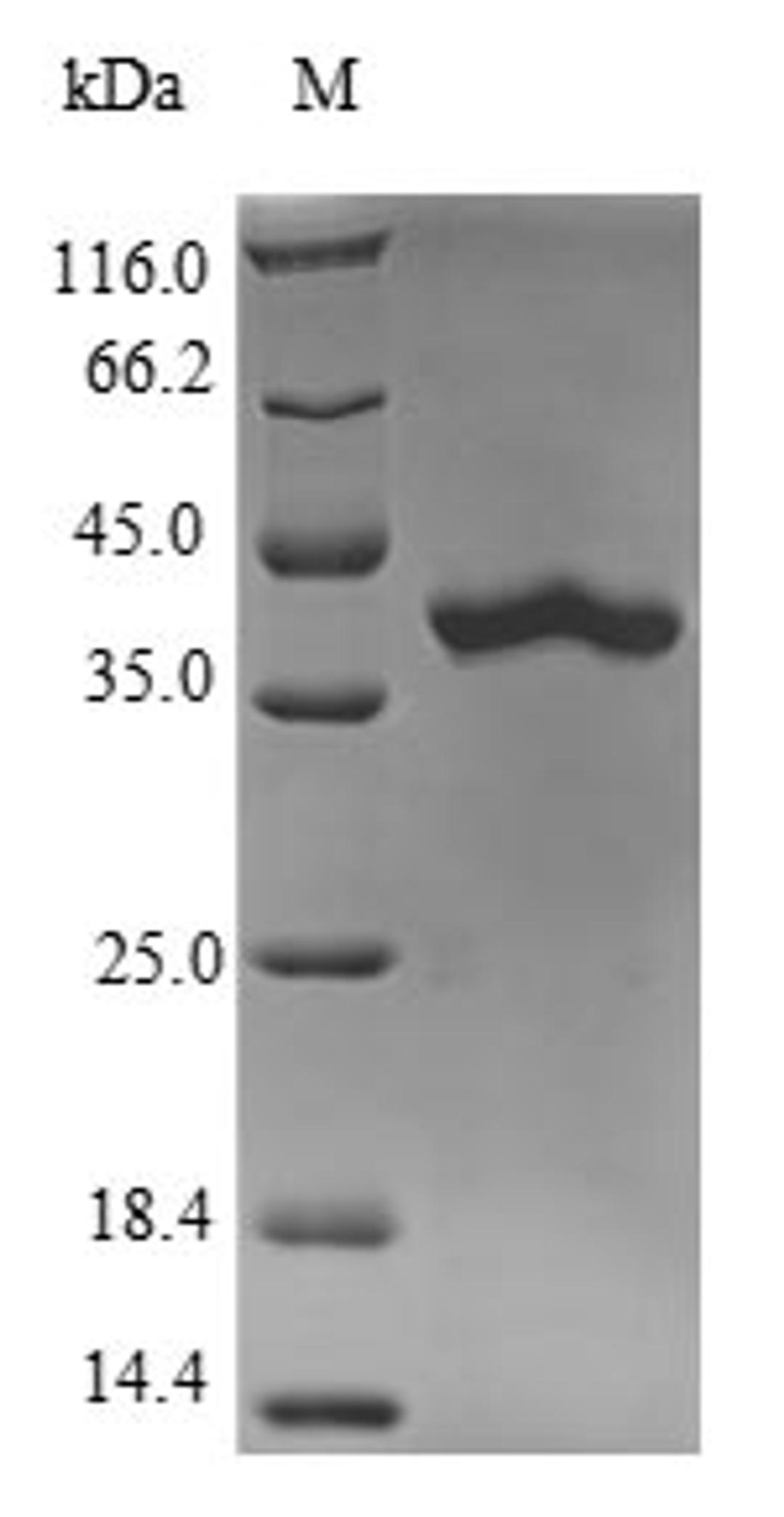 (Tris-Glycine gel) Discontinuous SDS-PAGE (reduced) with 5% enrichment gel and 15% separation gel.