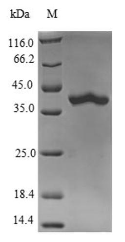 (Tris-Glycine gel) Discontinuous SDS-PAGE (reduced) with 5% enrichment gel and 15% separation gel.