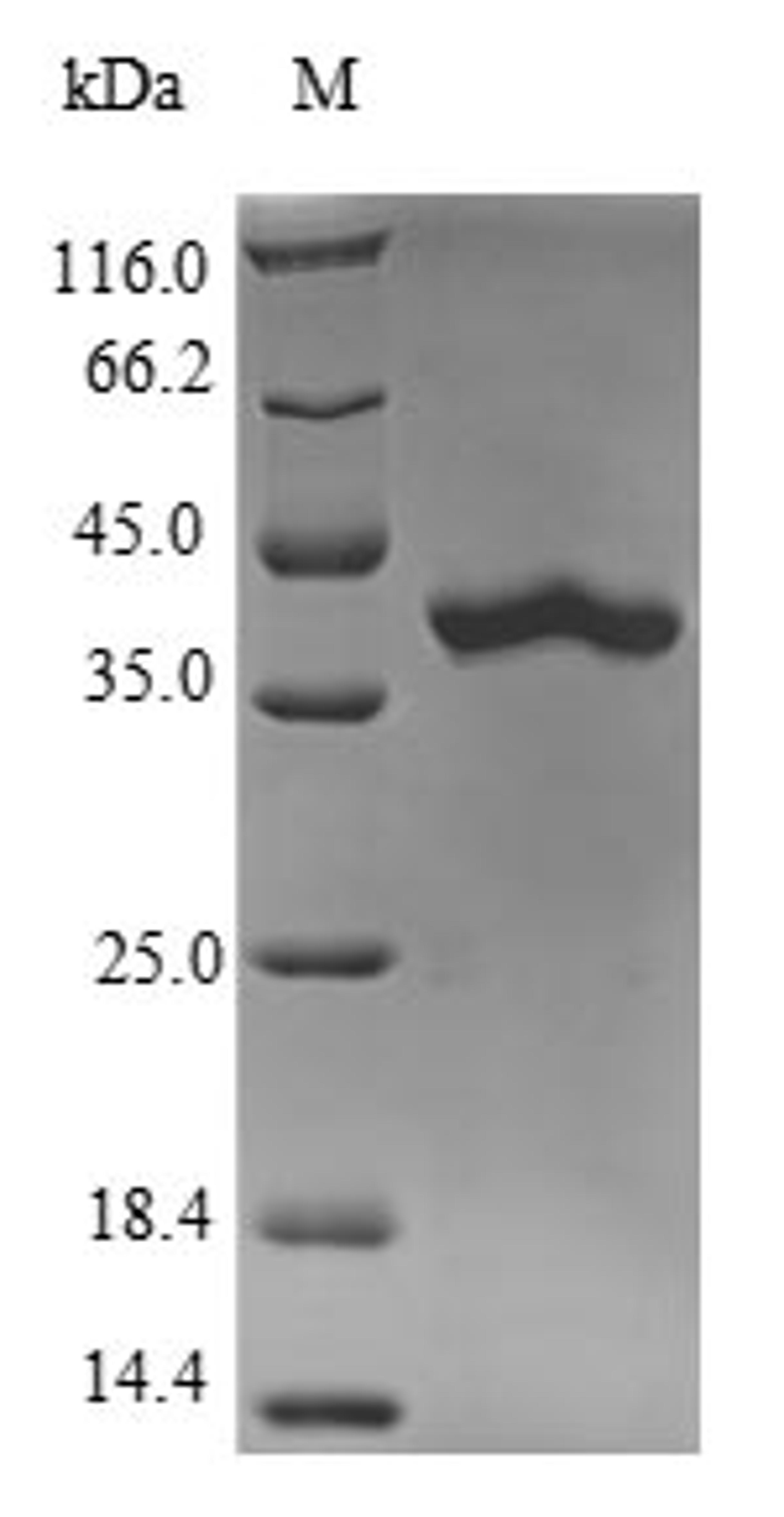 (Tris-Glycine gel) Discontinuous SDS-PAGE (reduced) with 5% enrichment gel and 15% separation gel.