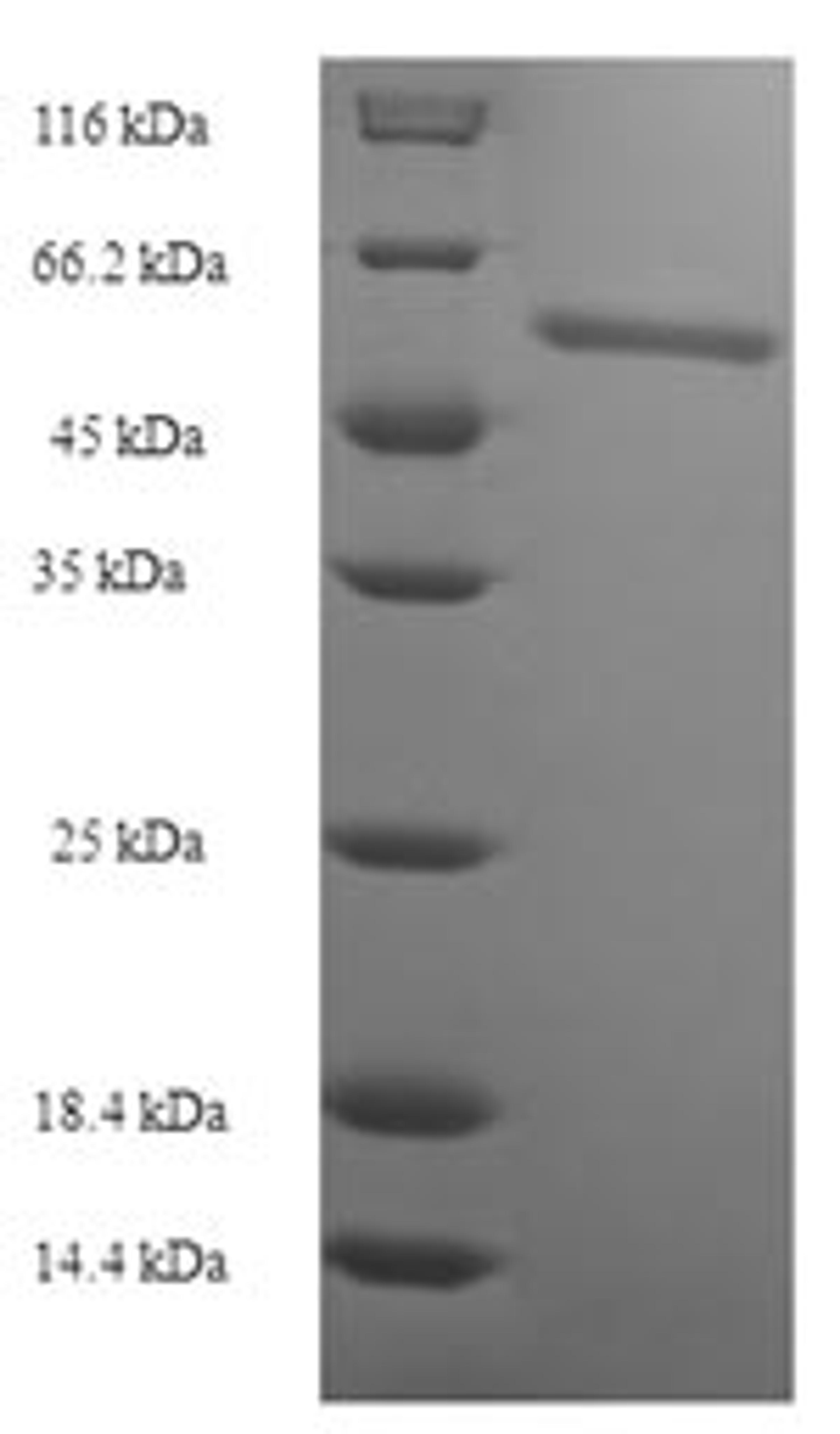 (Tris-Glycine gel) Discontinuous SDS-PAGE (reduced) with 5% enrichment gel and 15% separation gel.