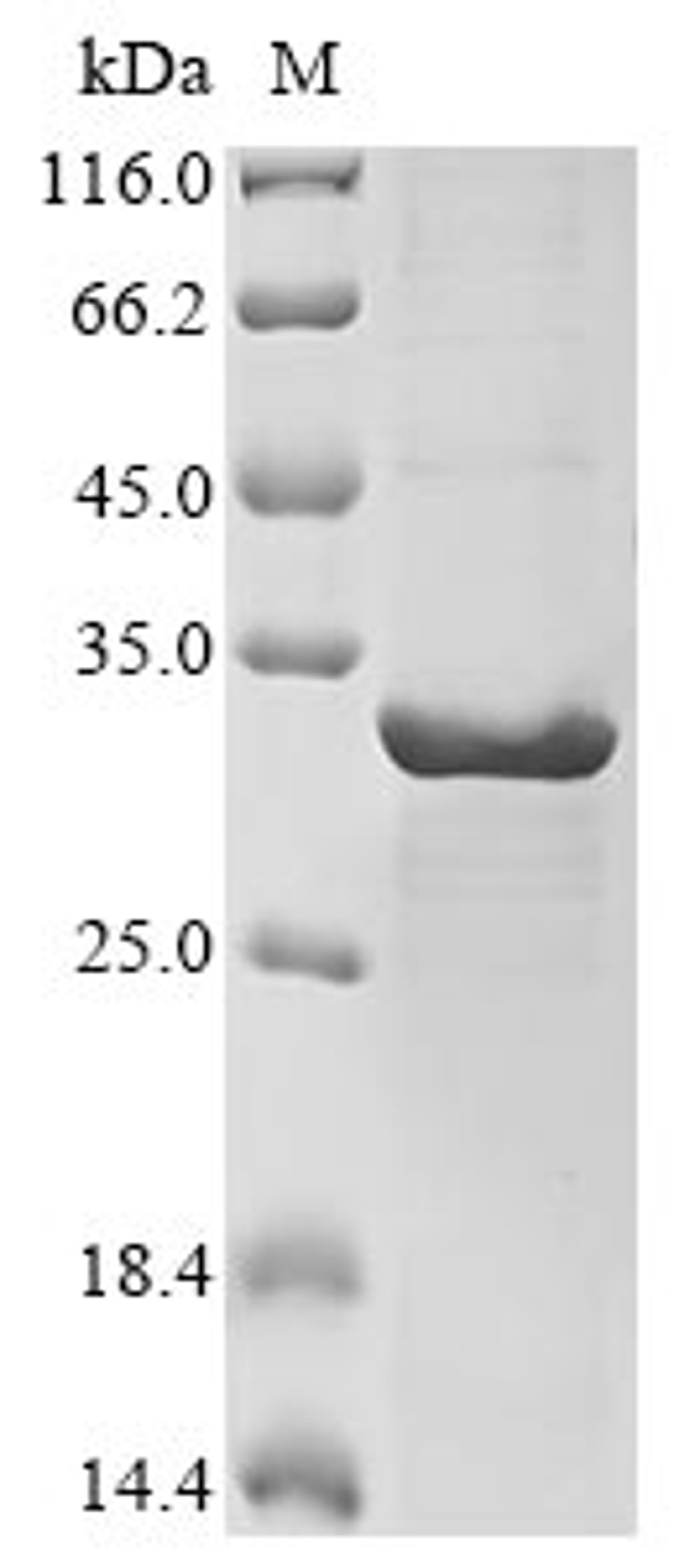 (Tris-Glycine gel) Discontinuous SDS-PAGE (reduced) with 5% enrichment gel and 15% separation gel.