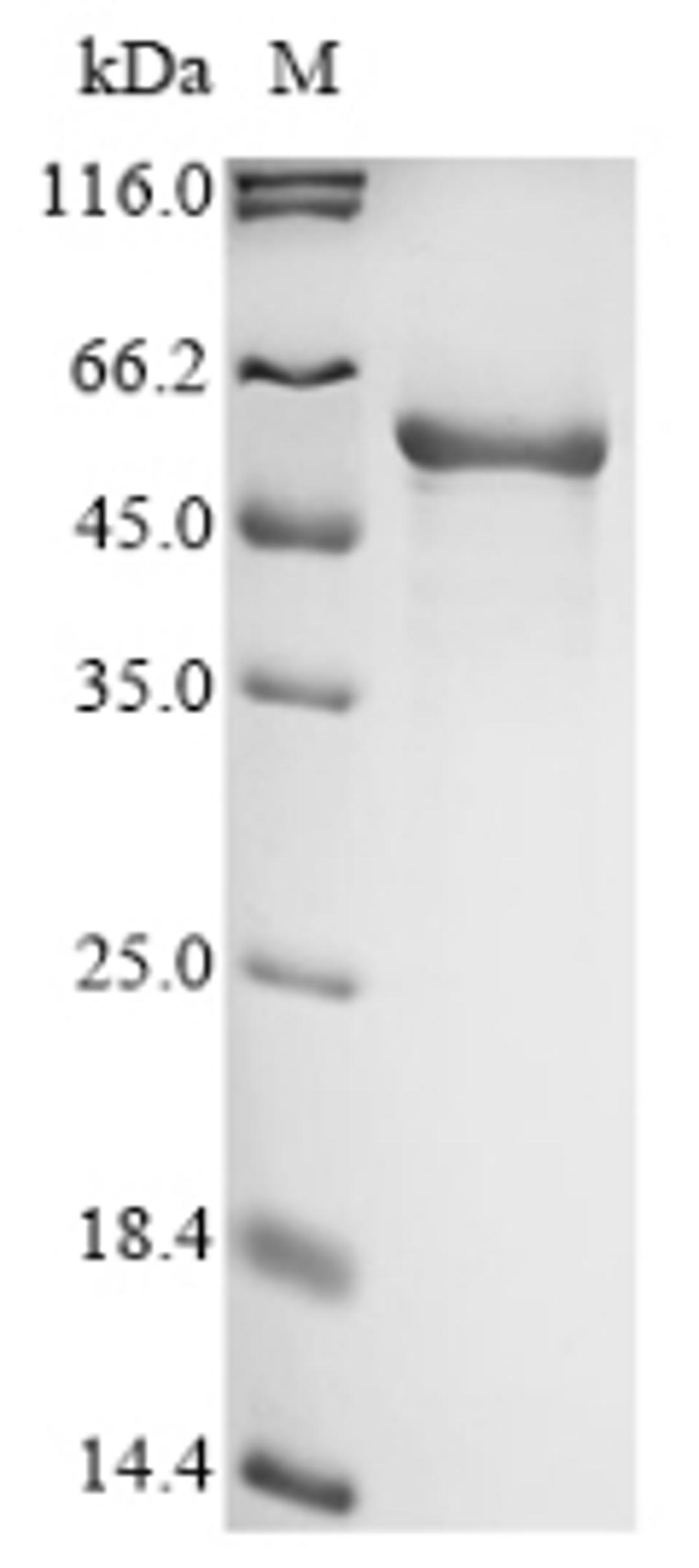 (Tris-Glycine gel) Discontinuous SDS-PAGE (reduced) with 5% enrichment gel and 15% separation gel.