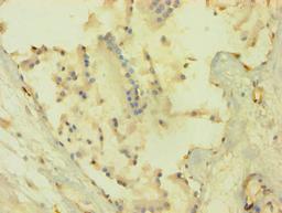 Immunohistochemistry of paraffin-embedded human prostate tissue using CSB-PA15905A0Rb at dilution of 1:100