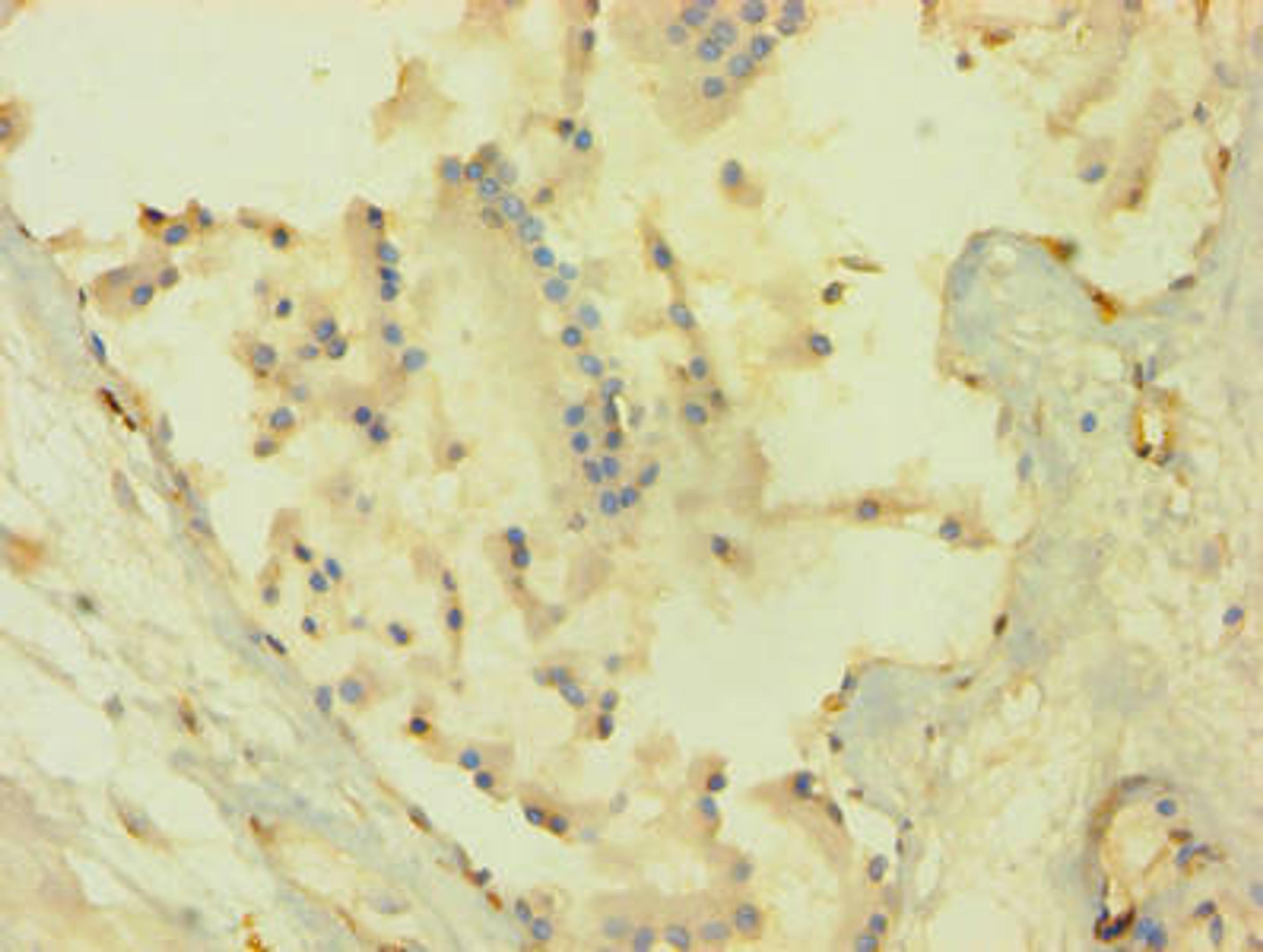 Immunohistochemistry of paraffin-embedded human prostate tissue using CSB-PA15905A0Rb at dilution of 1:100