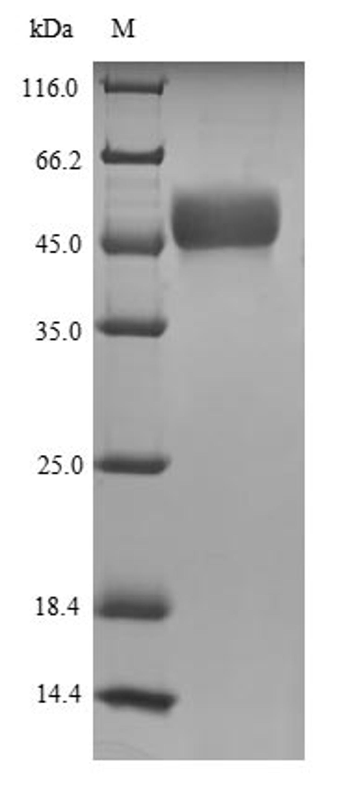 (Tris-Glycine gel) Discontinuous SDS-PAGE (reduced) with 5% enrichment gel and 15% separation gel.