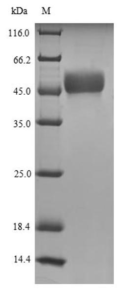 (Tris-Glycine gel) Discontinuous SDS-PAGE (reduced) with 5% enrichment gel and 15% separation gel.