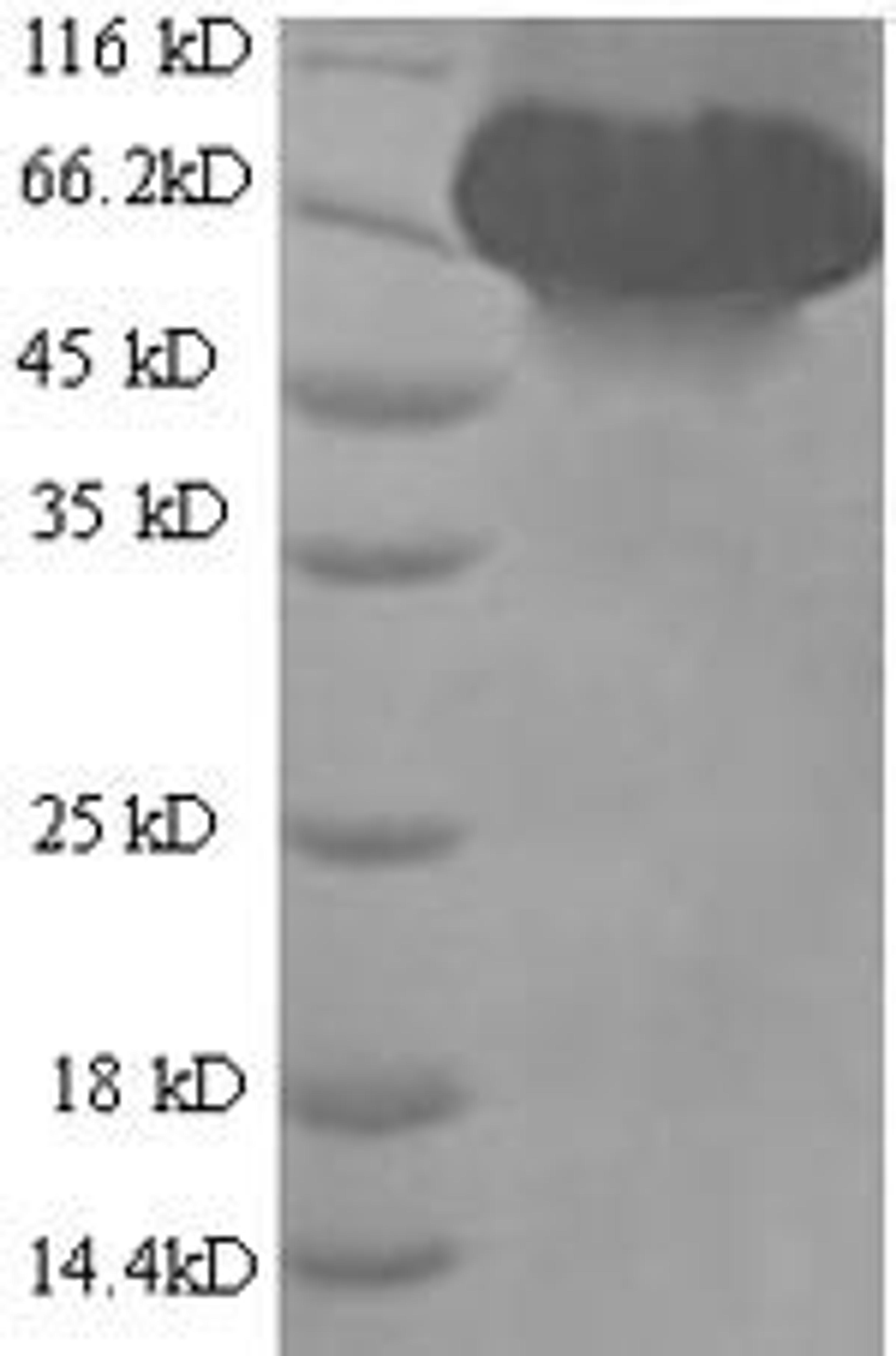(Tris-Glycine gel) Discontinuous SDS-PAGE (reduced) with 5% enrichment gel and 15% separation gel.