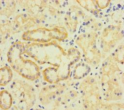 Immunohistochemistry of paraffin-embedded human kidney tissue using CSB-PA023899LA01HU at dilution of 1:100