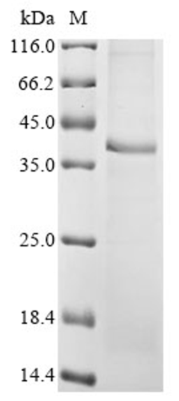 (Tris-Glycine gel) Discontinuous SDS-PAGE (reduced) with 5% enrichment gel and 15% separation gel.
