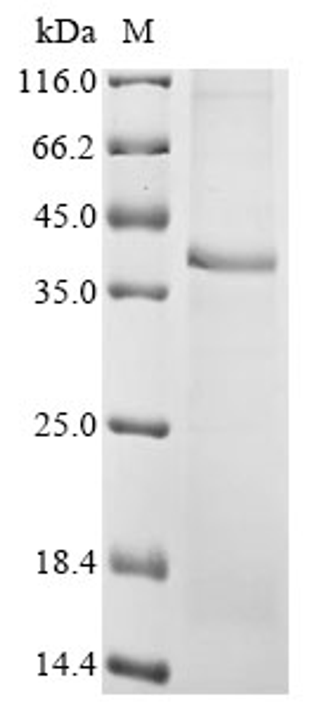 (Tris-Glycine gel) Discontinuous SDS-PAGE (reduced) with 5% enrichment gel and 15% separation gel.