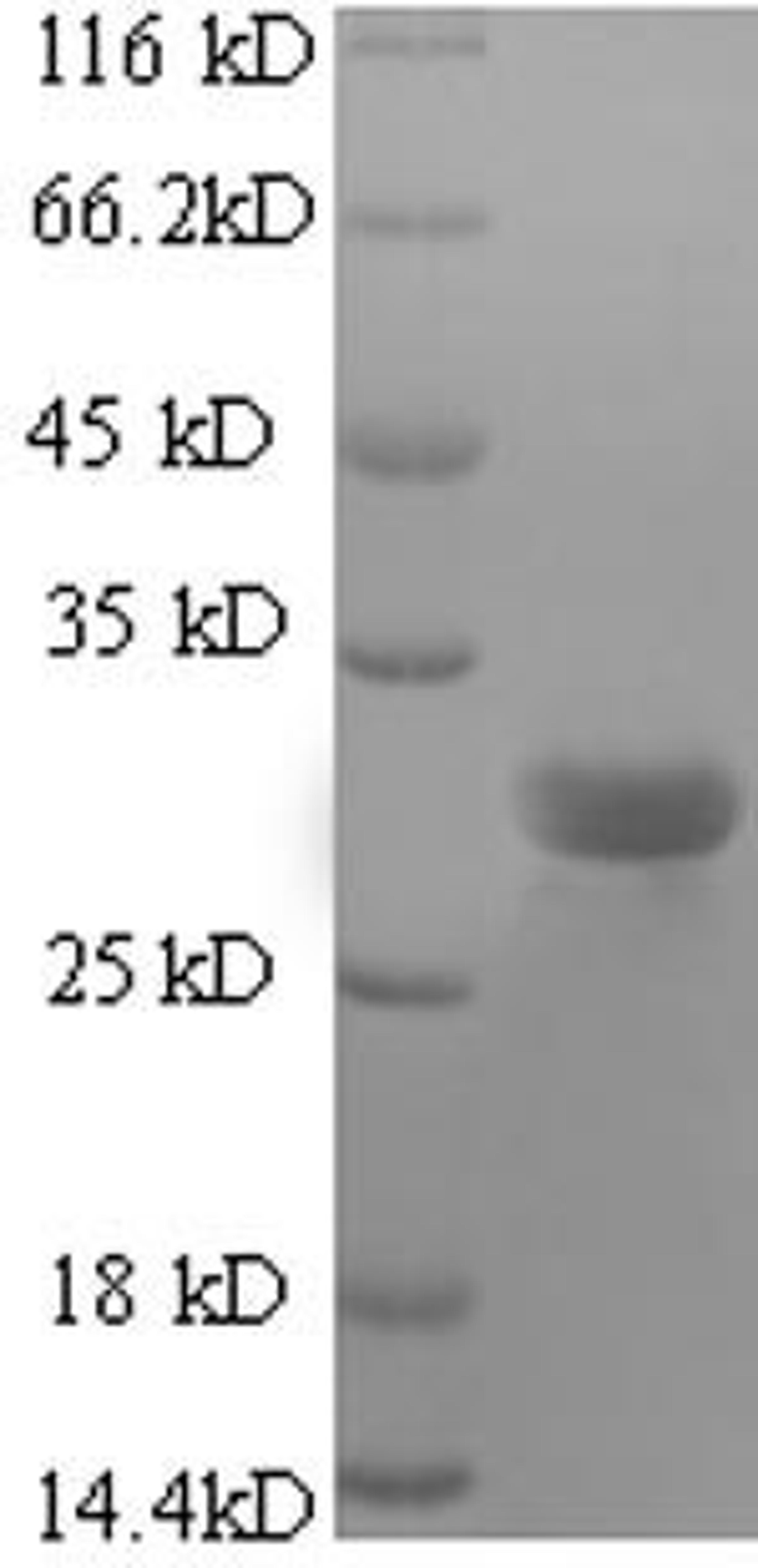 (Tris-Glycine gel) Discontinuous SDS-PAGE (reduced) with 5% enrichment gel and 15% separation gel.
