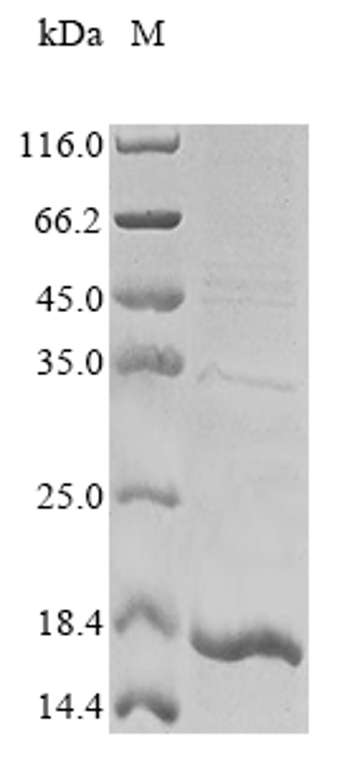 (Tris-Glycine gel) Discontinuous SDS-PAGE (reduced) with 5% enrichment gel and 15% separation gel.