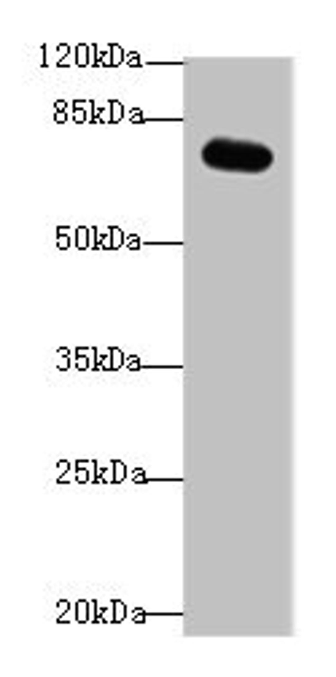 Western blot. All lanes: RMI1 antibody at 4ug/ml + Mouse kidney tissue. Secondary. Goat polyclonal to rabbit IgG at 1/10000 dilution. Predicted band size: 70 kDa. Observed band size: 70 kDa. 