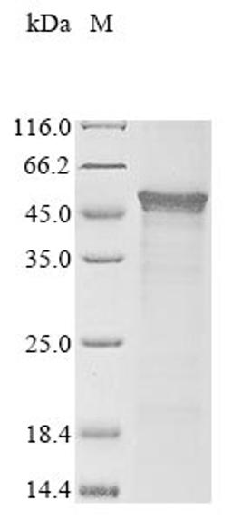 (Tris-Glycine gel) Discontinuous SDS-PAGE (reduced) with 5% enrichment gel and 15% separation gel.