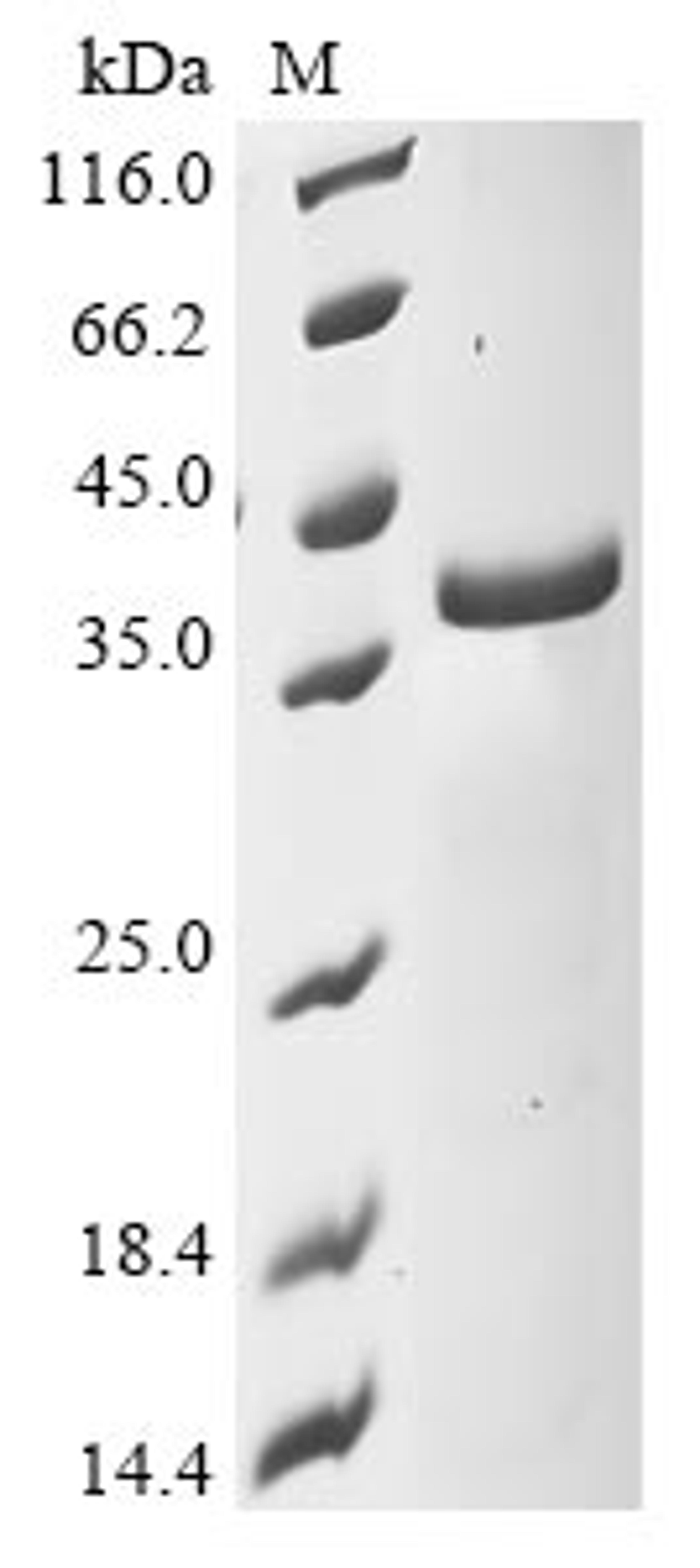 (Tris-Glycine gel) Discontinuous SDS-PAGE (reduced) with 5% enrichment gel and 15% separation gel.