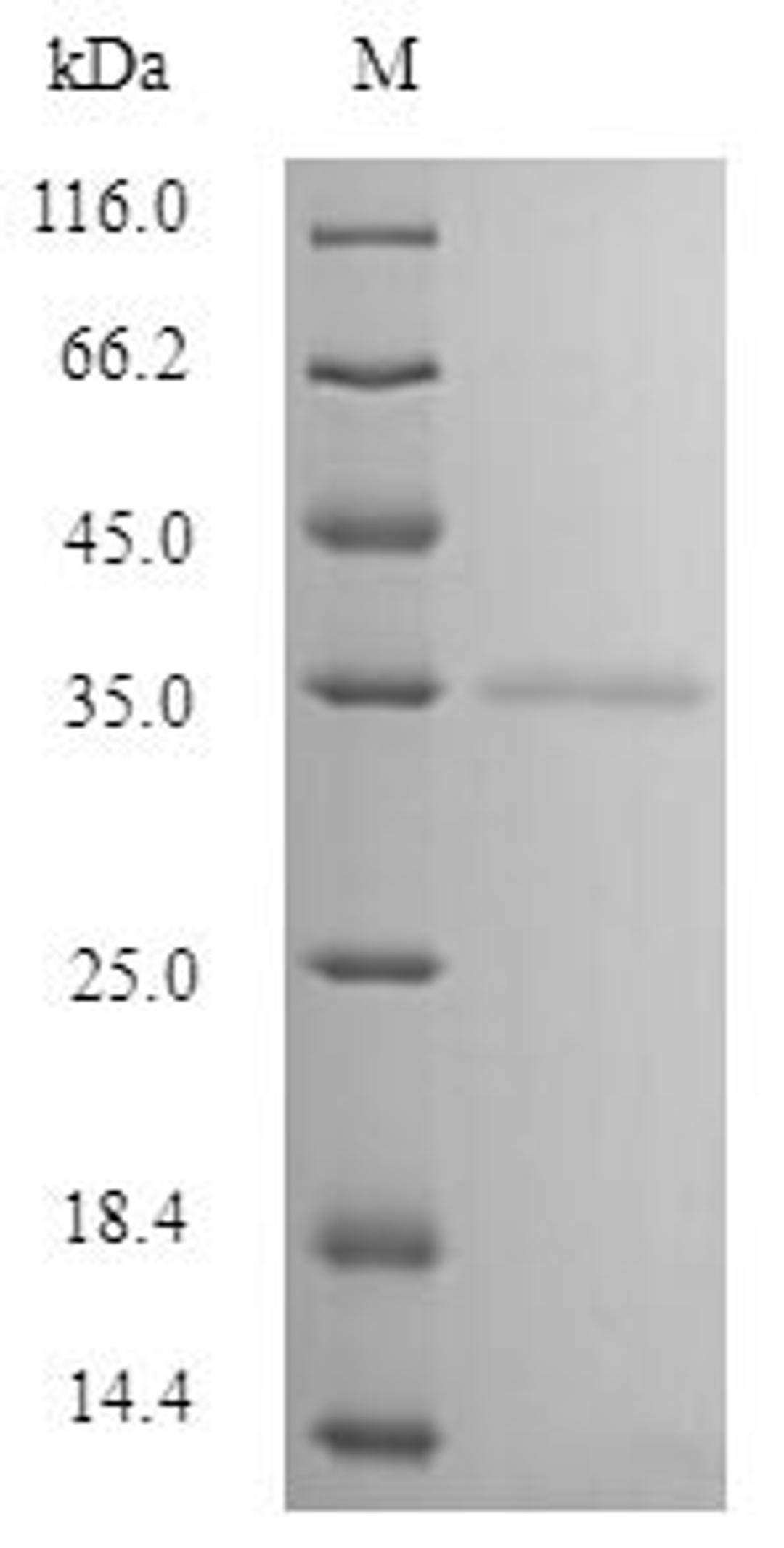 (Tris-Glycine gel) Discontinuous SDS-PAGE (reduced) with 5% enrichment gel and 15% separation gel.