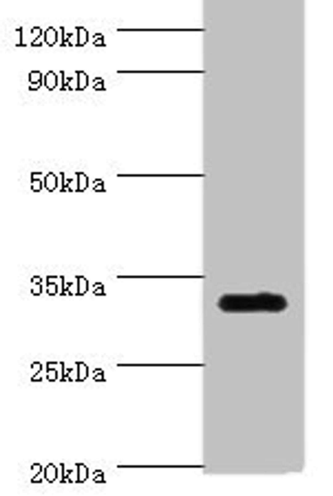 Western blot. All lanes: SLC25A15 antibody at 6ug/ml + Mouse liver tissue. Secondary. Goat polyclonal to rabbit IgG at 1/10000 dilution. Predicted band size: 33 kDa. Observed band size: 33 kDa. 
