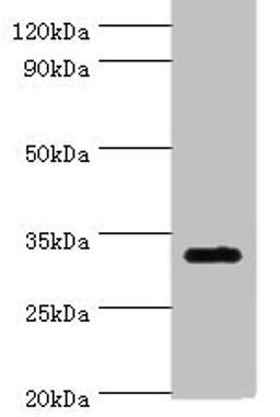 Western blot. All lanes: SLC25A15 antibody at 6ug/ml + Mouse liver tissue. Secondary. Goat polyclonal to rabbit IgG at 1/10000 dilution. Predicted band size: 33 kDa. Observed band size: 33 kDa. 