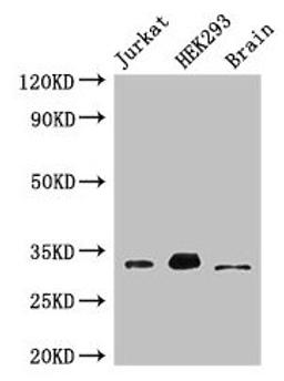 Western Blot. Positive WB detected in: Jurkat whole cell lysate, HEK293 whole cell lysate, Mouse brain tissue. All lanes: MBD3 antibody at 3µg/ml. Secondary. Goat polyclonal to rabbit IgG at 1/50000 dilution. Predicted band size: 33, 30 kDa. Observed band size: 33 kDa