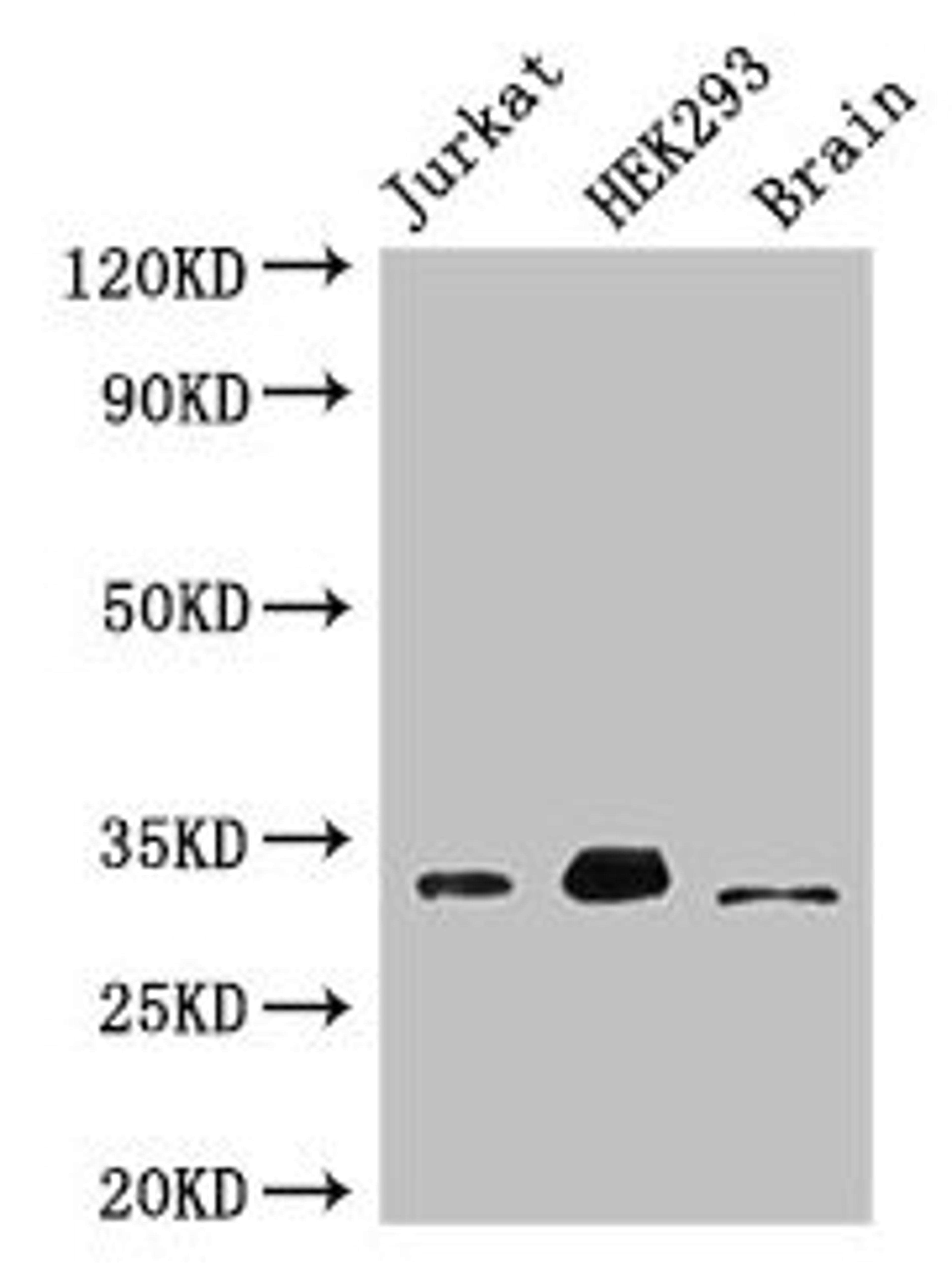 Western Blot. Positive WB detected in: Jurkat whole cell lysate, HEK293 whole cell lysate, Mouse brain tissue. All lanes: MBD3 antibody at 3µg/ml. Secondary. Goat polyclonal to rabbit IgG at 1/50000 dilution. Predicted band size: 33, 30 kDa. Observed band size: 33 kDa