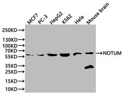 Western Blot. Positive WB detected in: Mouse liver tissue, Mouse kidney tissue, Mouse brain tissue, Mouse stomach tissue. All lanes: NOTUM antibody at 2.7ug/ml. Secondary. Goat polyclonal to rabbit IgG at 1/50000 dilution. Predicted band size: 56 kDa. Observed band size: 56 kDa. 