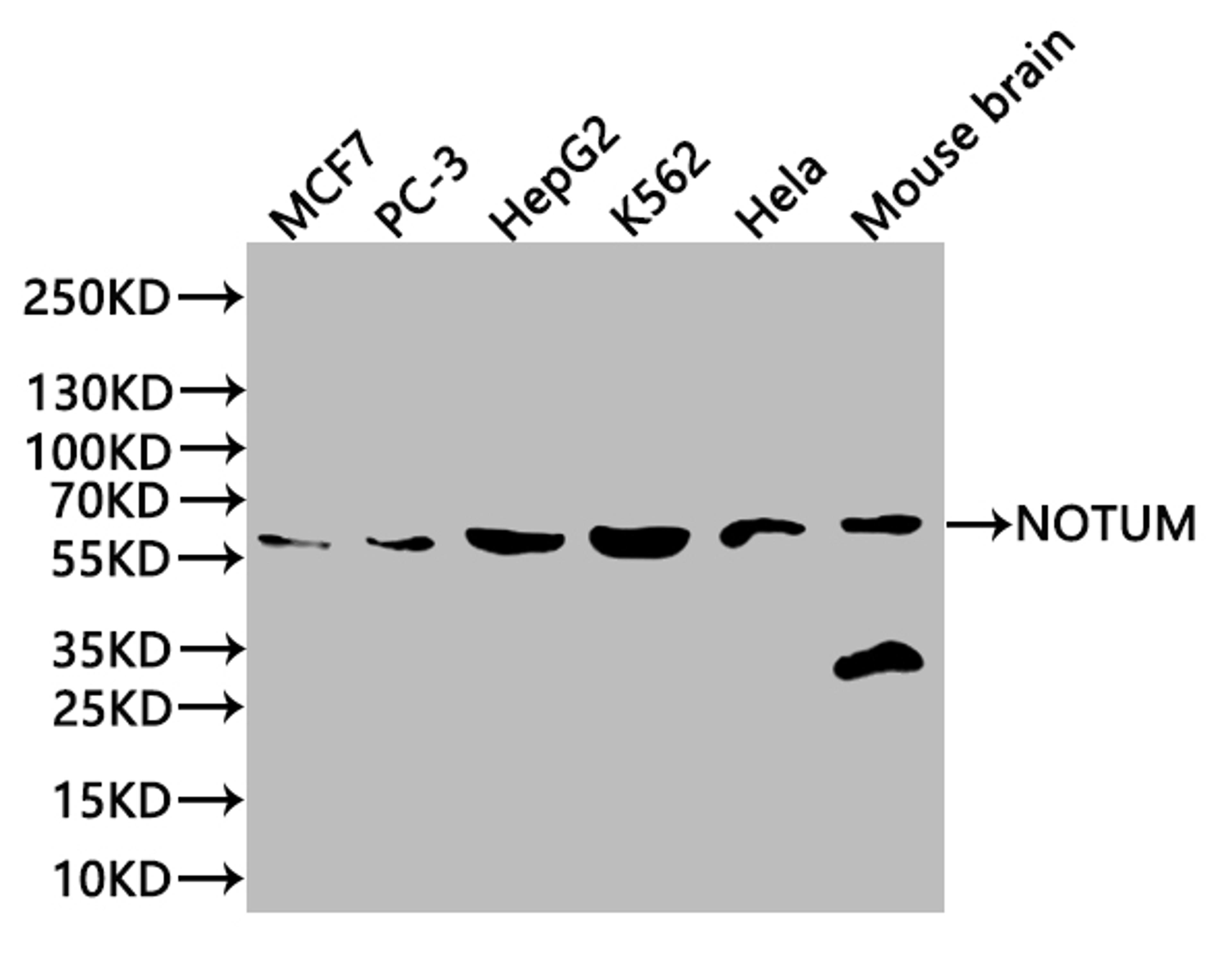 Western Blot. Positive WB detected in: Mouse liver tissue, Mouse kidney tissue, Mouse brain tissue, Mouse stomach tissue. All lanes: NOTUM antibody at 2.7ug/ml. Secondary. Goat polyclonal to rabbit IgG at 1/50000 dilution. Predicted band size: 56 kDa. Observed band size: 56 kDa. 