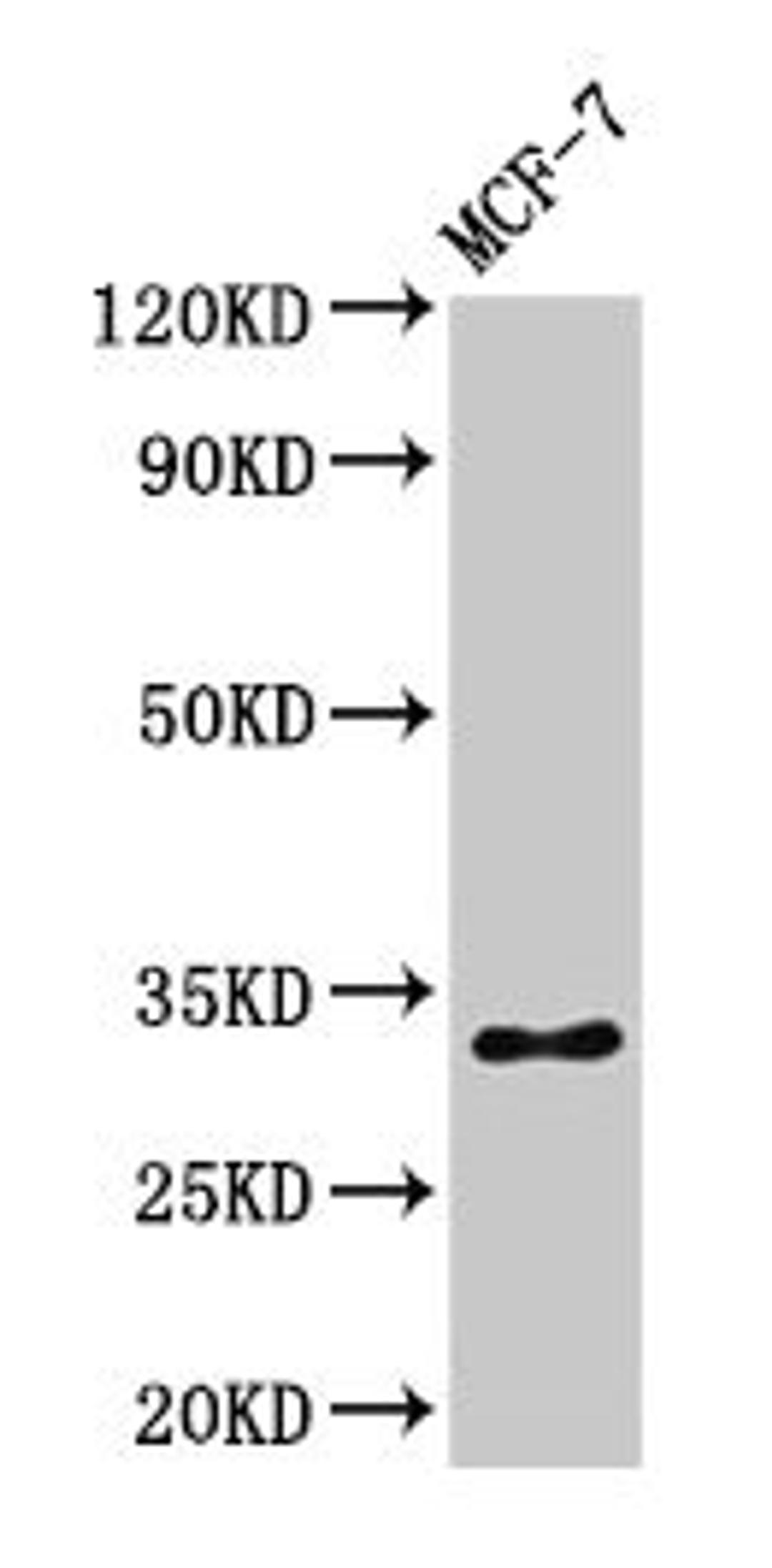 Western Blot. Positive WB detected in: MCF-7 whole cell lysate. All lanes: HIST1H1B antibody at 1µg/ml. Secondary. Goat polyclonal to rabbit IgG at 1/50000 dilution. Predicted band size: 23 kDa. Observed band size: 32 kDa