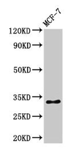 Western Blot. Positive WB detected in: MCF-7 whole cell lysate. All lanes: HIST1H1B antibody at 1µg/ml. Secondary. Goat polyclonal to rabbit IgG at 1/50000 dilution. Predicted band size: 23 kDa. Observed band size: 32 kDa