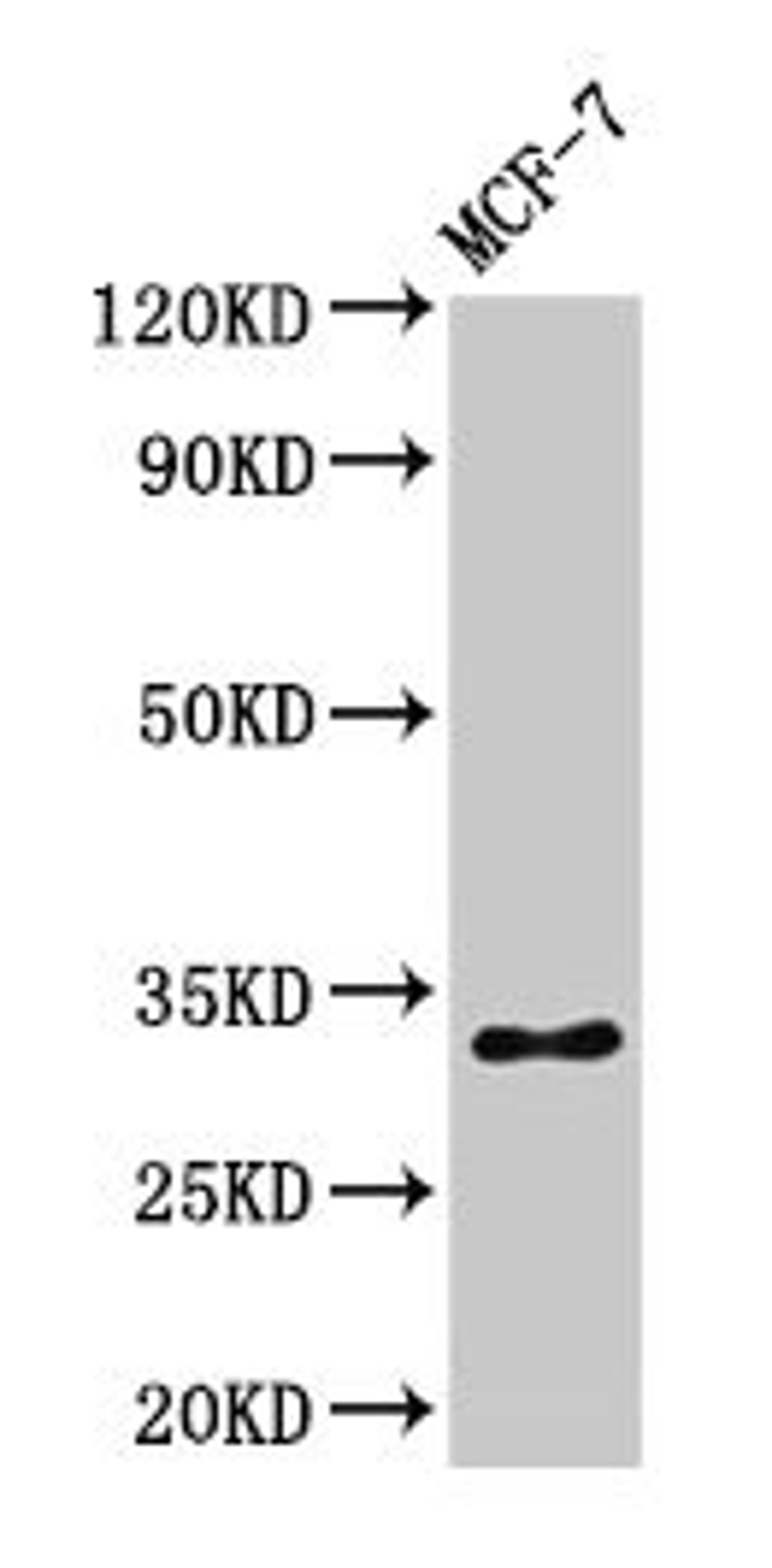 Western Blot. Positive WB detected in: MCF-7 whole cell lysate. All lanes: HIST1H1B antibody at 1µg/ml. Secondary. Goat polyclonal to rabbit IgG at 1/50000 dilution. Predicted band size: 23 kDa. Observed band size: 32 kDa