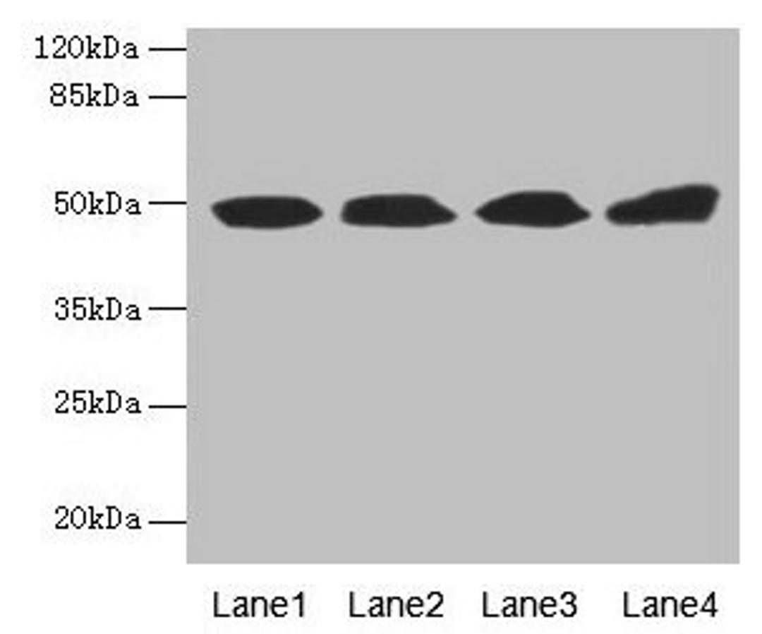 Western blot. All lanes: TBCEL antibody at 12µg/ml. Lane 1: Rat gonadal tissue. Lane 2: PC-3 whole cell lysate. Lane 3: Rat heart tissue. Lane 4: 293T whole cell lysate. Secondary. Goat polyclonal to rabbit IgG at 1/10000 dilution. Predicted band size: 49 kDa. Observed band size: 49 kDa