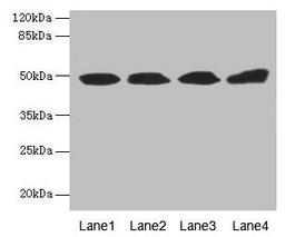 Western blot. All lanes: TBCEL antibody at 12µg/ml. Lane 1: Rat gonadal tissue. Lane 2: PC-3 whole cell lysate. Lane 3: Rat heart tissue. Lane 4: 293T whole cell lysate. Secondary. Goat polyclonal to rabbit IgG at 1/10000 dilution. Predicted band size: 49 kDa. Observed band size: 49 kDa