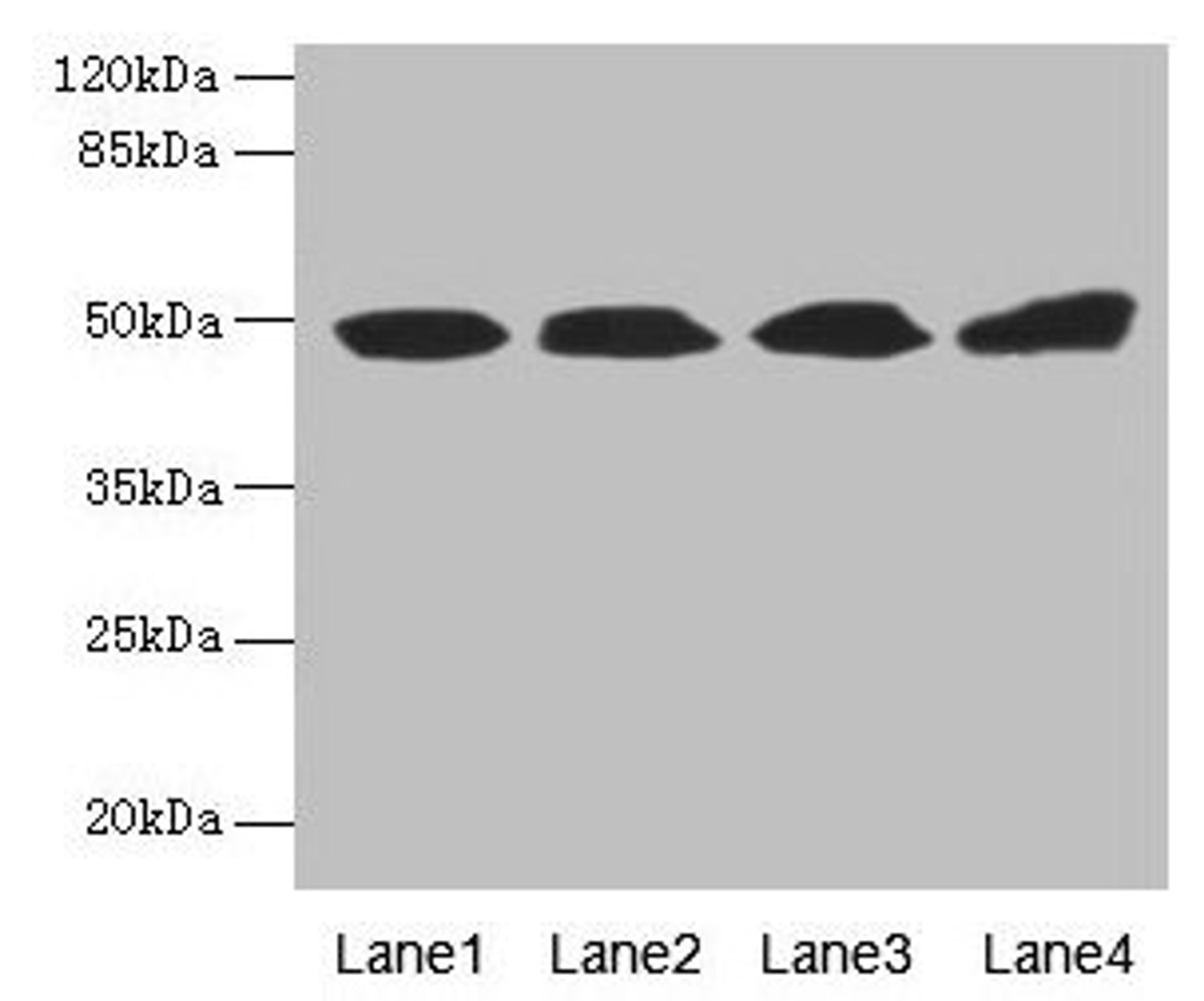 Western blot. All lanes: TBCEL antibody at 12µg/ml. Lane 1: Rat gonadal tissue. Lane 2: PC-3 whole cell lysate. Lane 3: Rat heart tissue. Lane 4: 293T whole cell lysate. Secondary. Goat polyclonal to rabbit IgG at 1/10000 dilution. Predicted band size: 49 kDa. Observed band size: 49 kDa