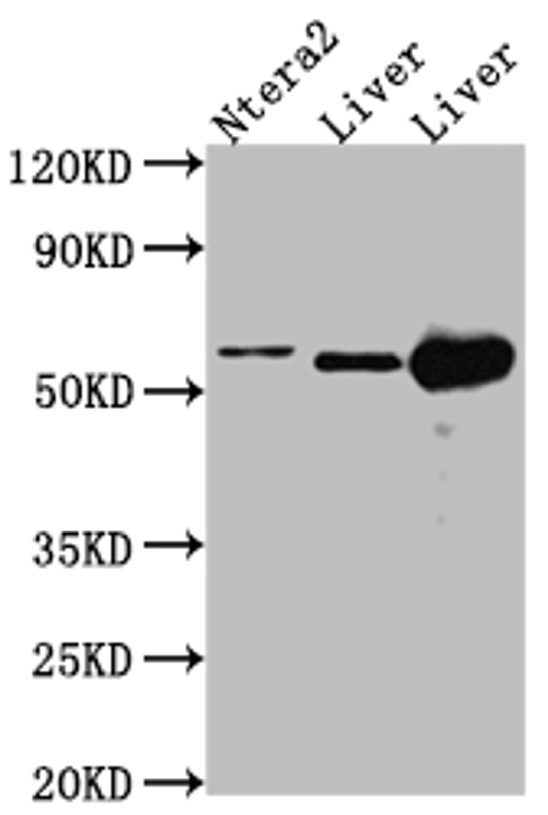 Western Blot. Positive WB detected in: Ntera-2 whole cell lysate, Mouse Liver whole cell lysate, Rat Liver cell lysate. All lanes: ALDH2 antibody at 1:1000. Secondary. Goat polyclonal to rabbit IgG at 1/50000 dilution. Predicted band size: 57, 51 kDa. Observed band size: 57 kDa. 