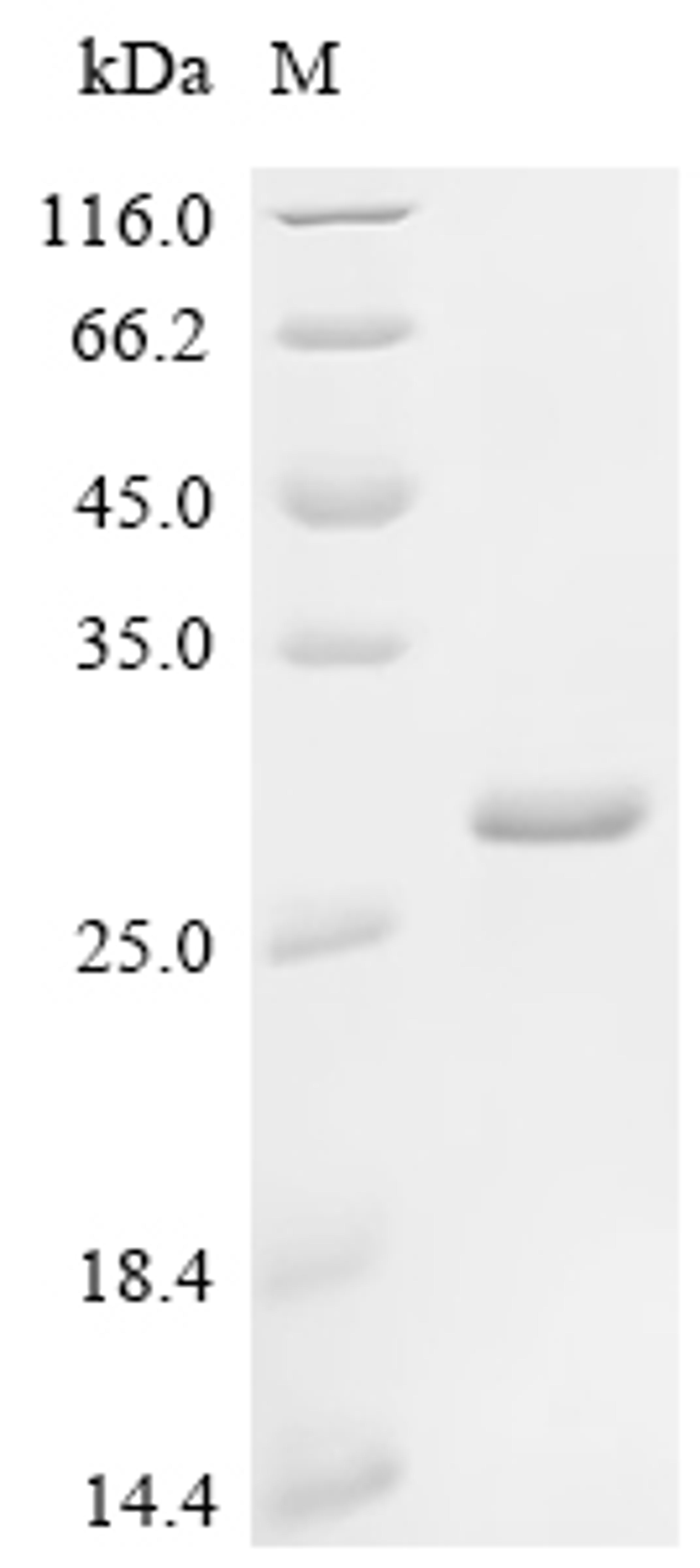 (Tris-Glycine gel) Discontinuous SDS-PAGE (reduced) with 5% enrichment gel and 15% separation gel.
