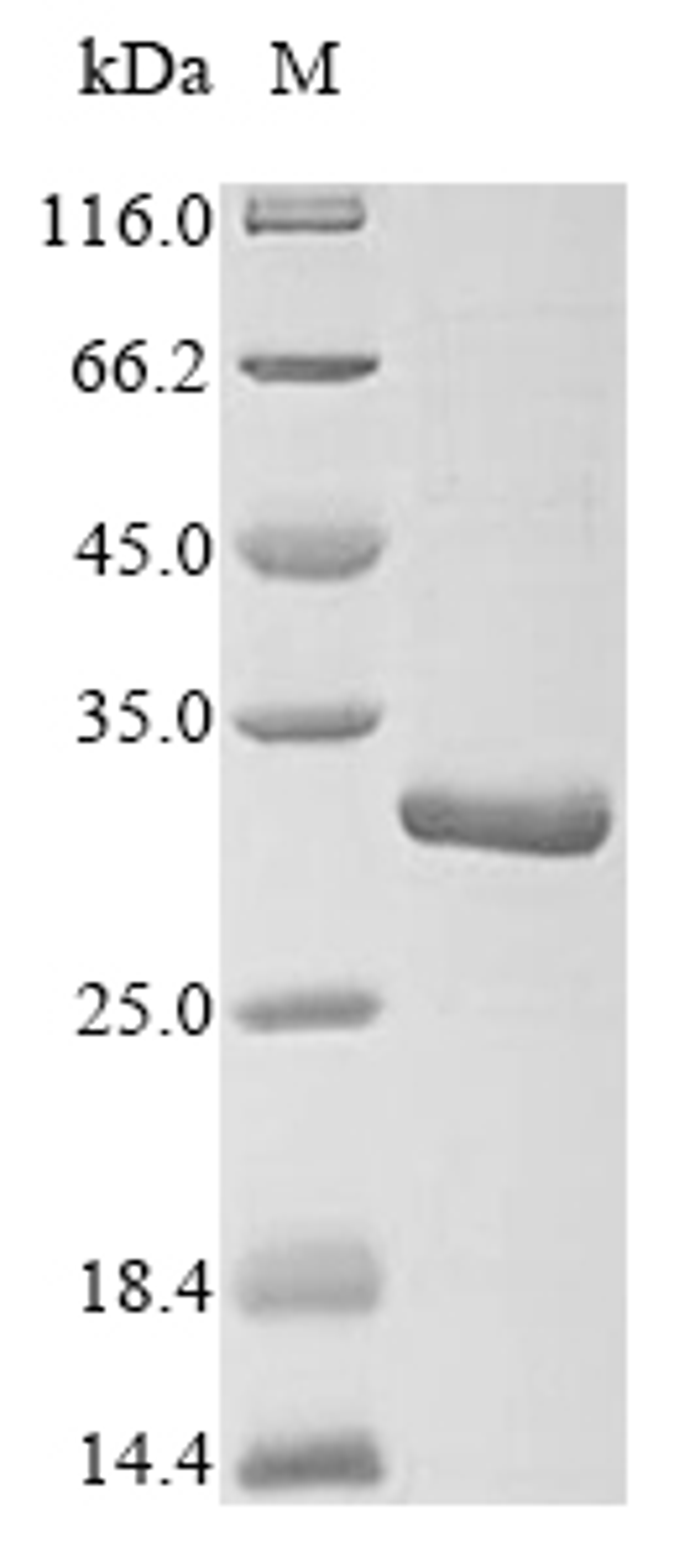 (Tris-Glycine gel) Discontinuous SDS-PAGE (reduced) with 5% enrichment gel and 15% separation gel.