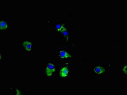 Immunofluorescent analysis of Hela cells using CSB-PA767205LA01HU at dilution of 1:100 and Alexa Fluor 488-congugated AffiniPure Goat Anti-Rabbit IgG(H+L)