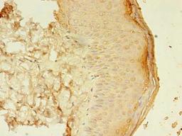 Immunohistochemistry of paraffin-embedded human skin tissue using CSB-PA618998LA01HU at dilution of 1:100